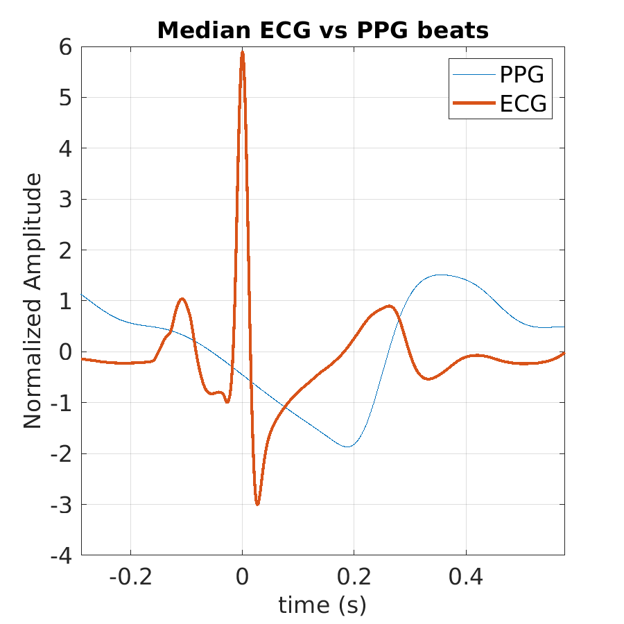 S021_ppg_med_ecg_ppg