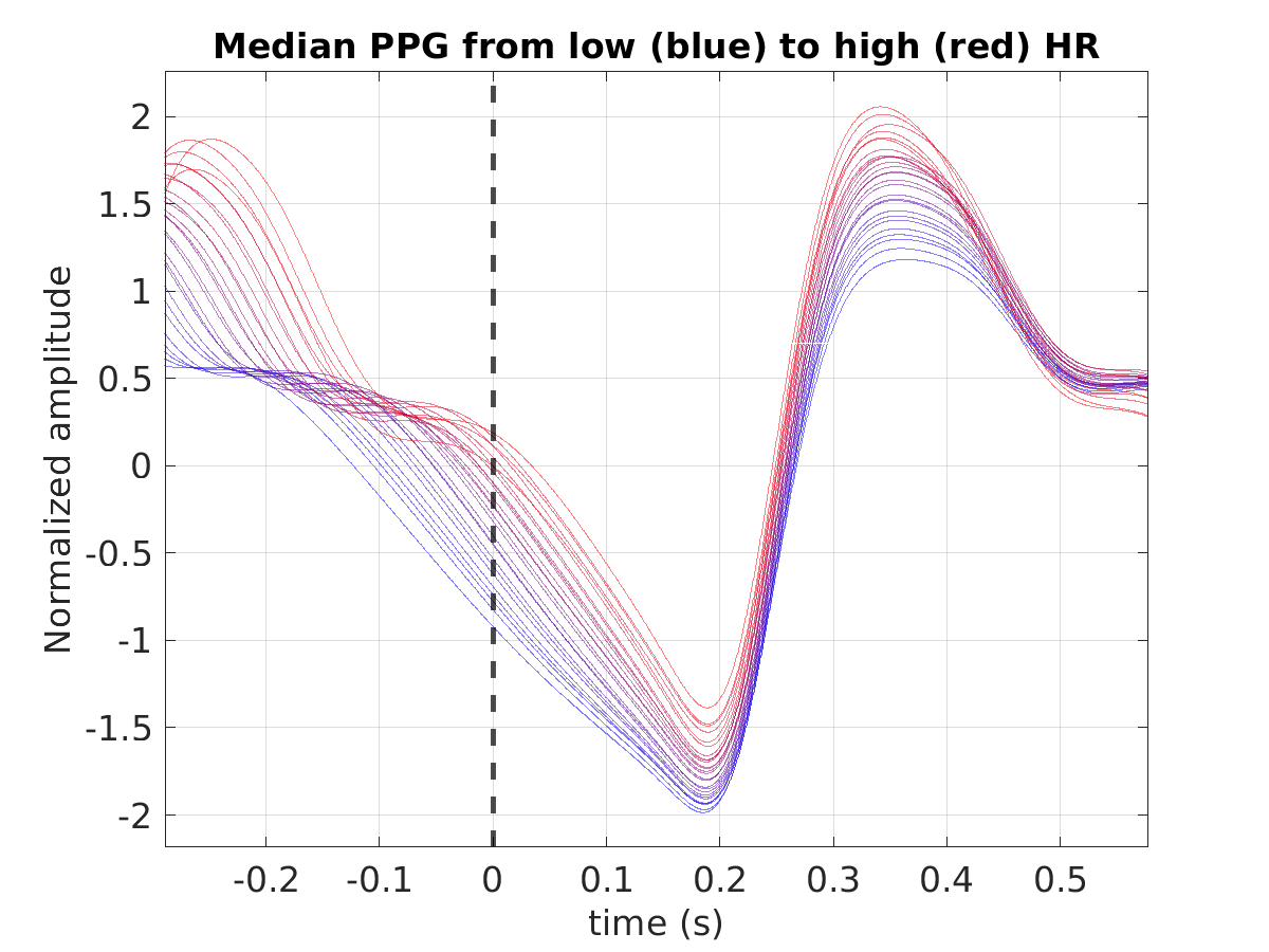 S021_ppg_med_ppg_hr_binned_norm