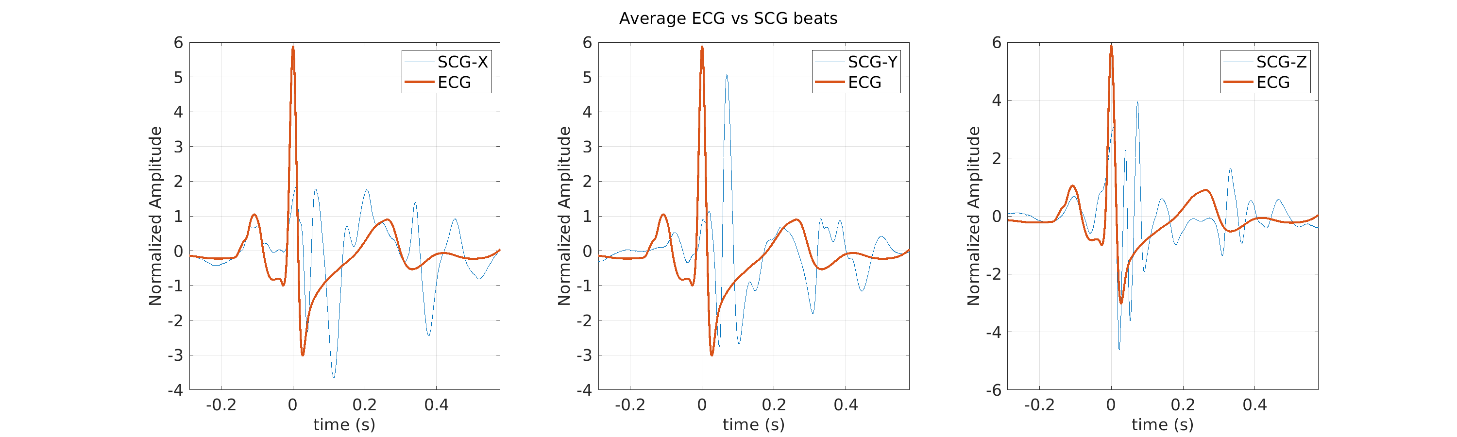 S021_scg_avg_ecg_scg