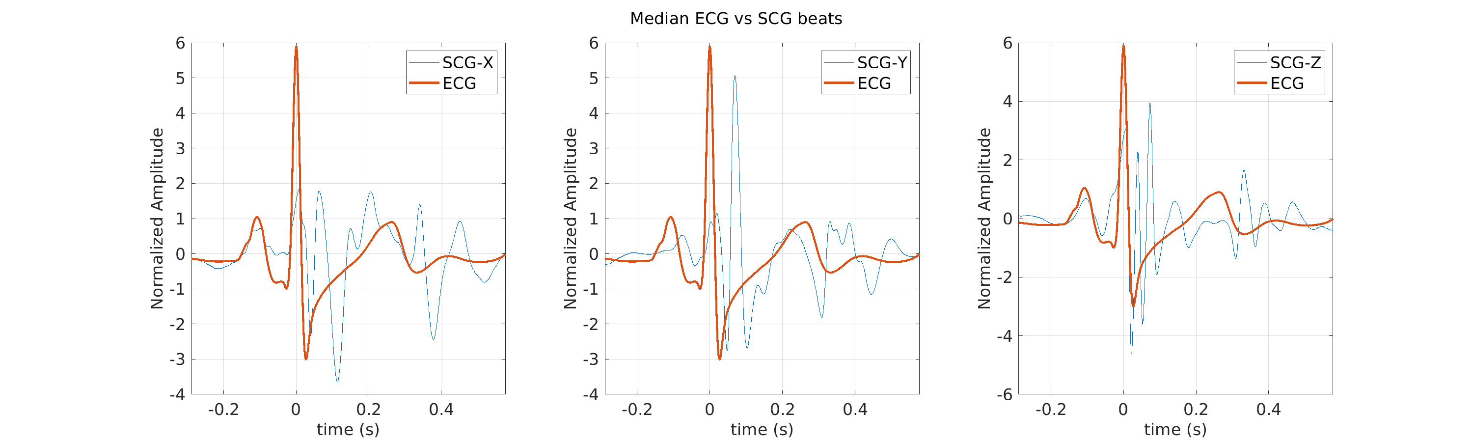 S021_scg_med_ecg_scg