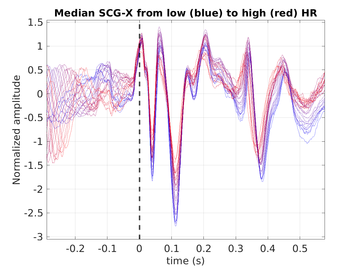 S021_scg_med_scgx_hr_binned_norm