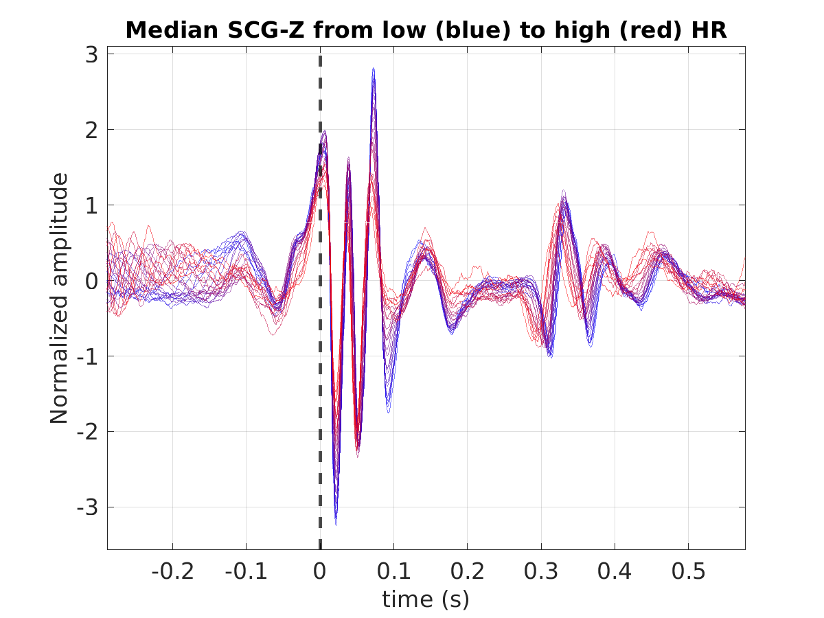 S021_scg_med_scgz_hr_binned_norm