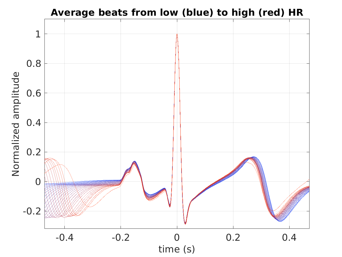 S022_ecg_avg_beats_hr_binned