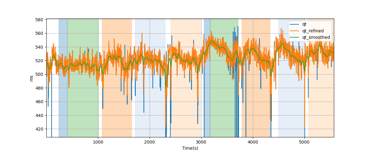 QT intervals - Overlay