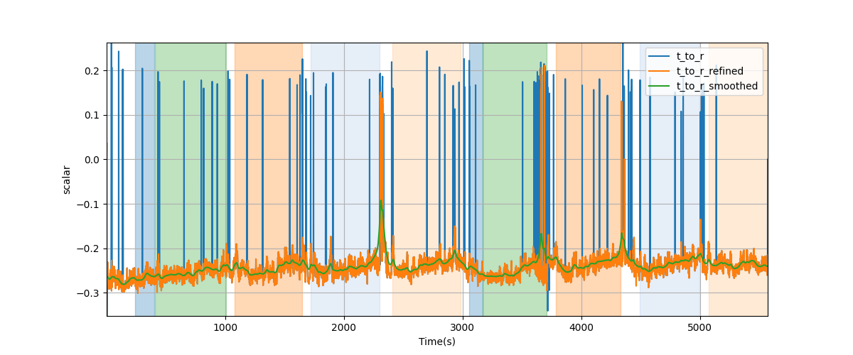 T/R wave ratio - Overlay