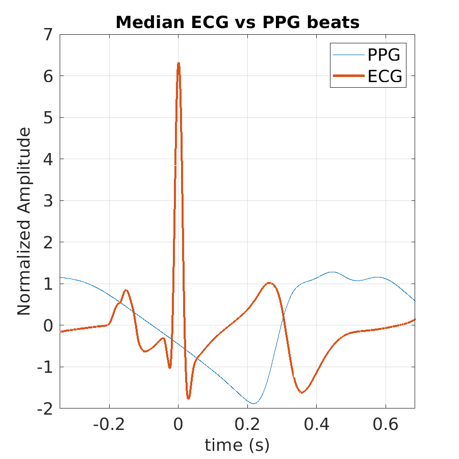 S022_ppg_med_ecg_ppg