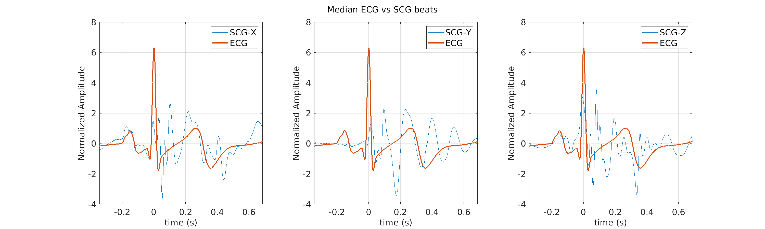 S022_scg_med_ecg_scg