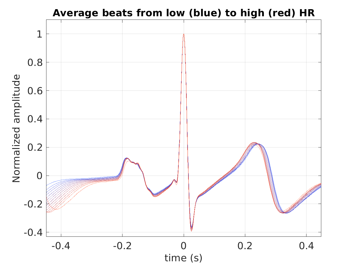 S024_ecg_avg_beats_hr_binned