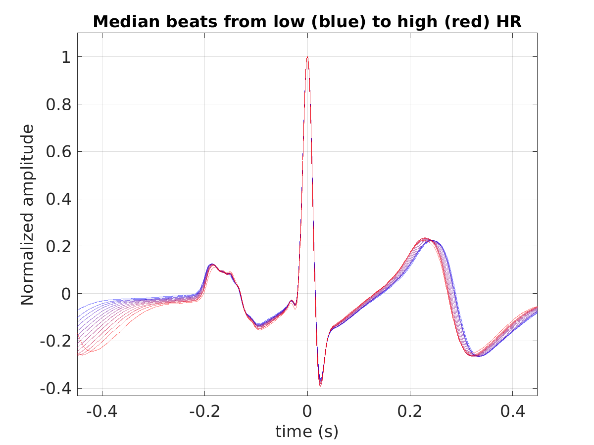 S024_ecg_med_beats_hr_binned