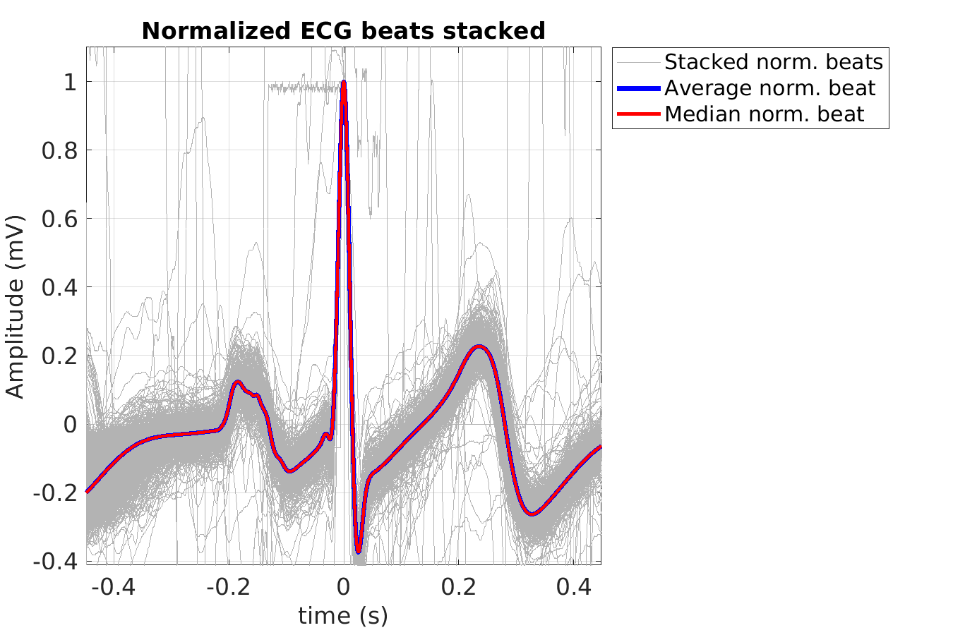 S024_ecg_norm_beats_stacked