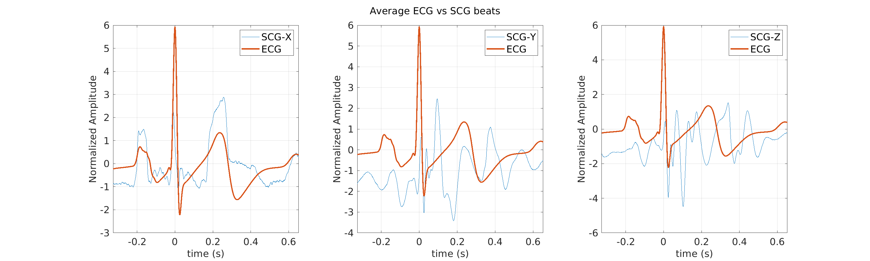 S024_scg_avg_ecg_scg