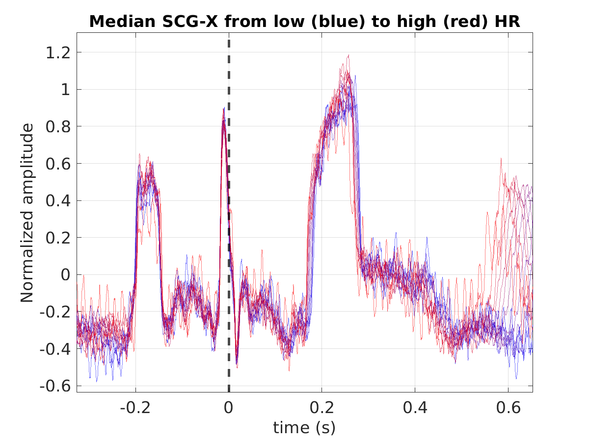 S024_scg_med_scgx_hr_binned_norm