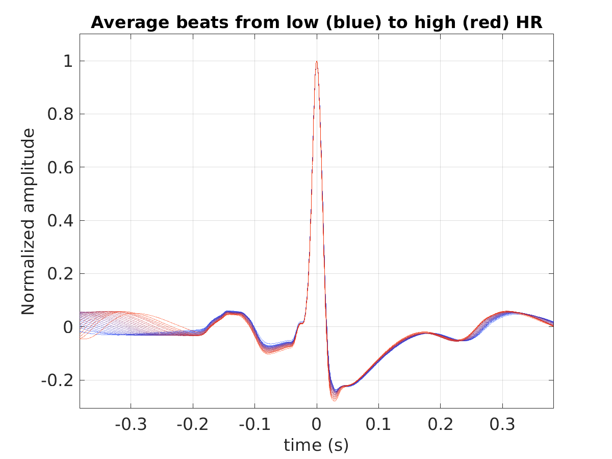 S025_ecg_avg_beats_hr_binned