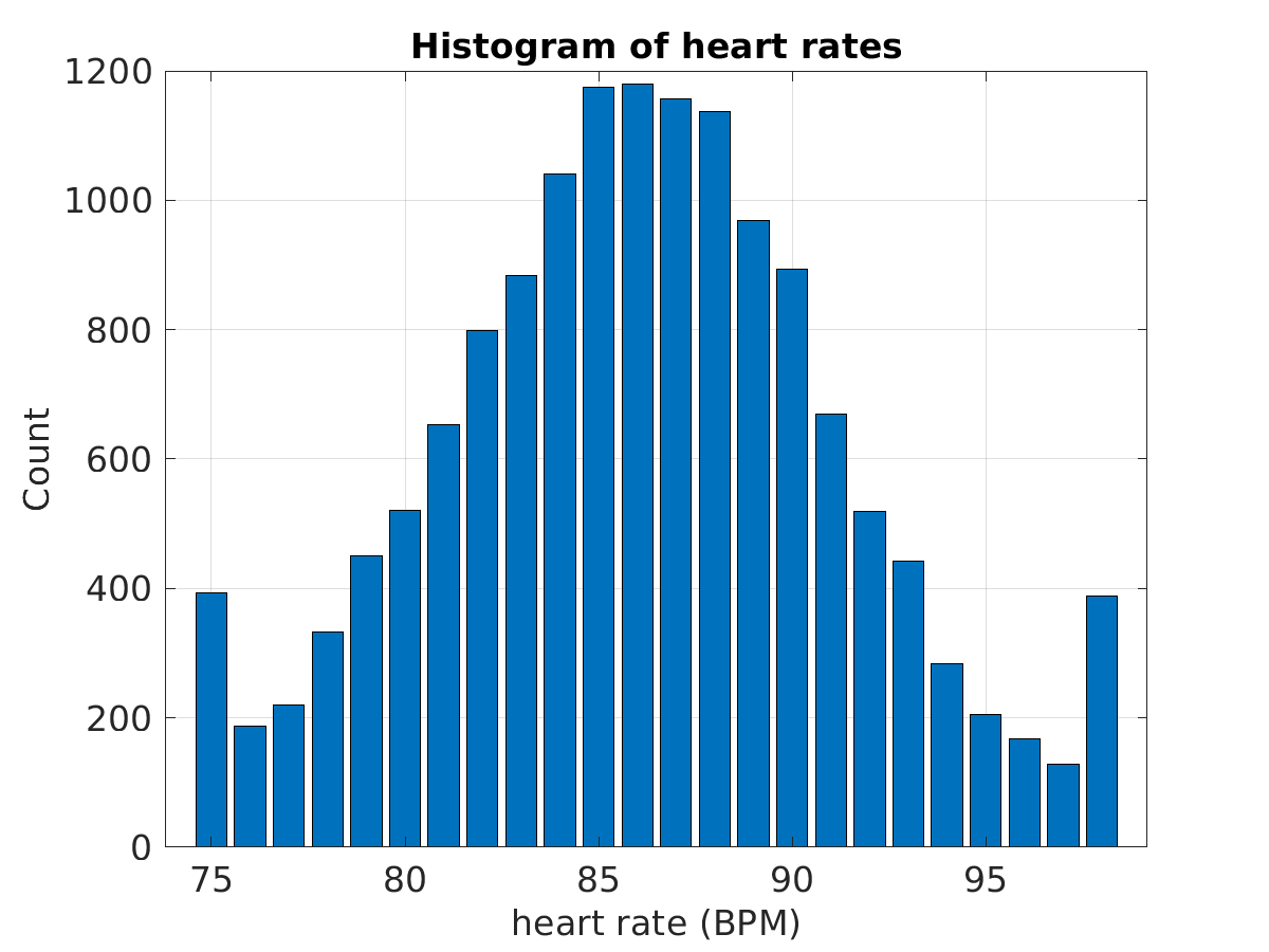 S025_ecg_hr_hist