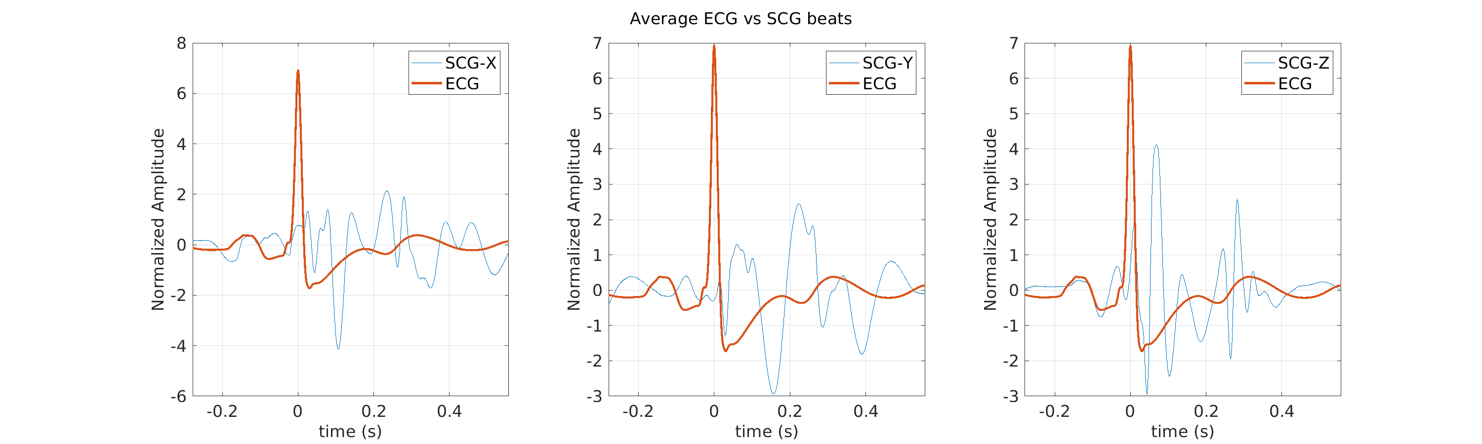 S025_scg_avg_ecg_scg