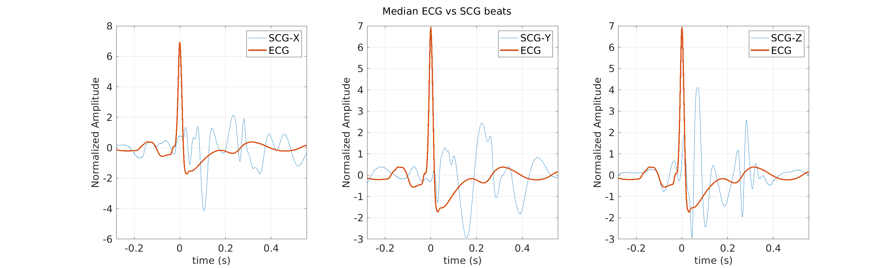 S025_scg_med_ecg_scg