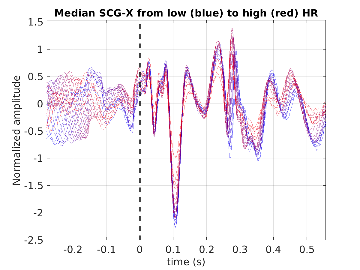 S025_scg_med_scgx_hr_binned_norm