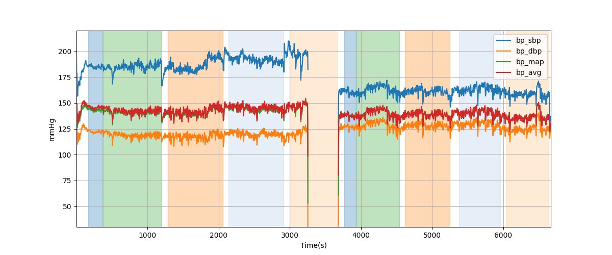 Subject S026 blood pressure data processing summary - Overlay