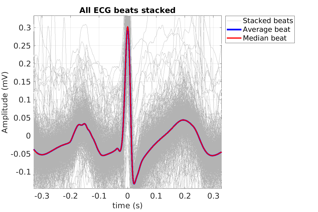 S026_ecg_beats_stacked