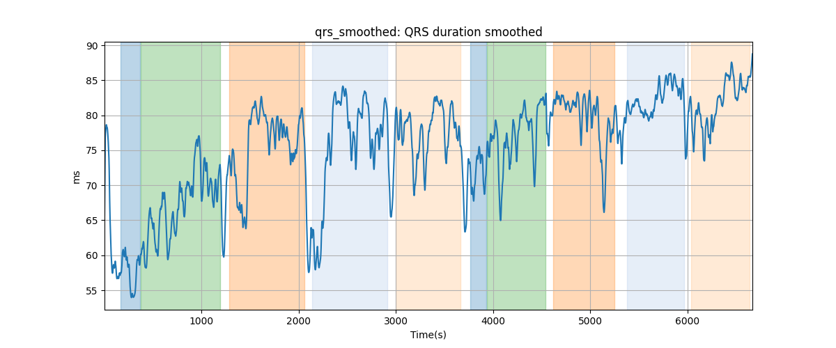 qrs_smoothed: QRS duration smoothed