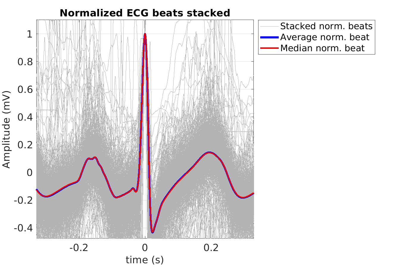 S026_ecg_norm_beats_stacked