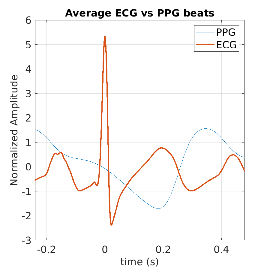 S026_ppg_avg_ecg_ppg