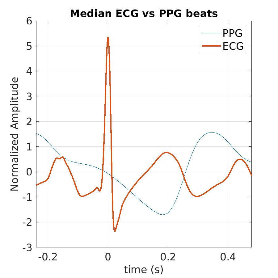 S026_ppg_med_ecg_ppg