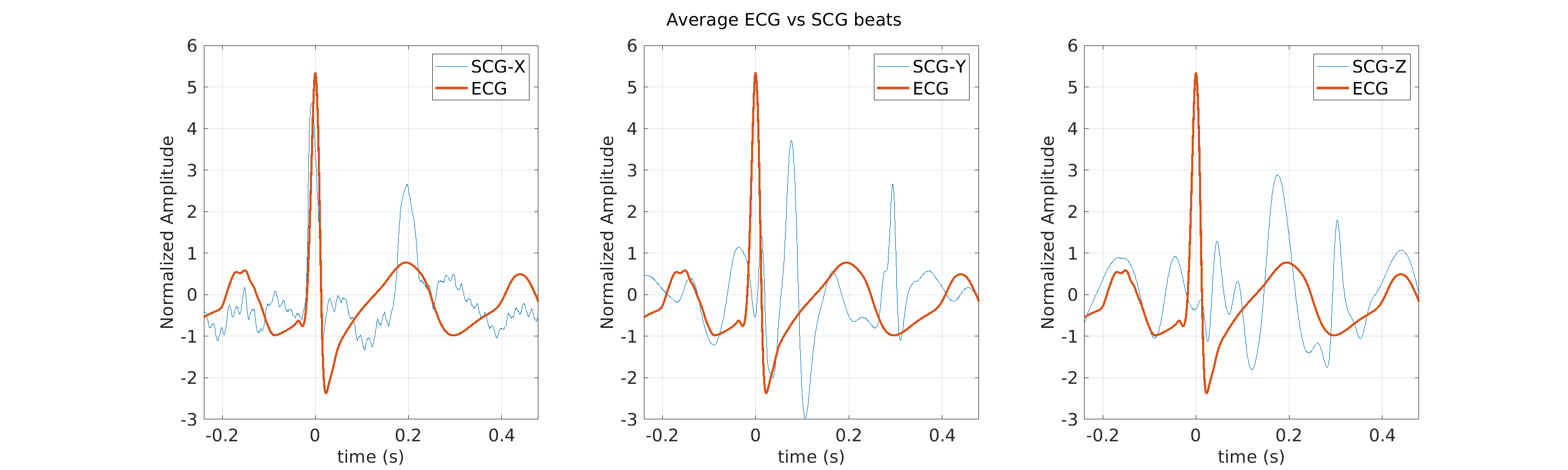 S026_scg_avg_ecg_scg