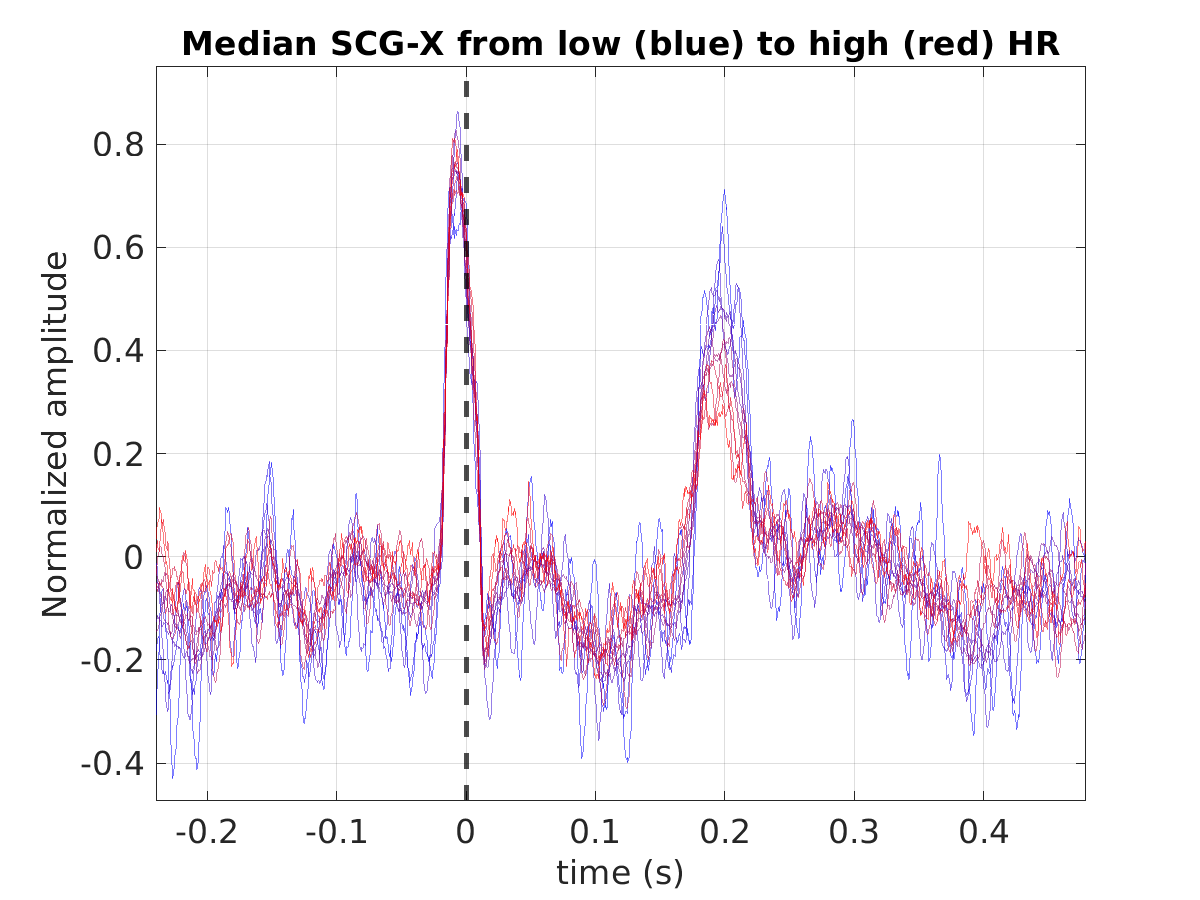 S026_scg_med_scgx_hr_binned_norm