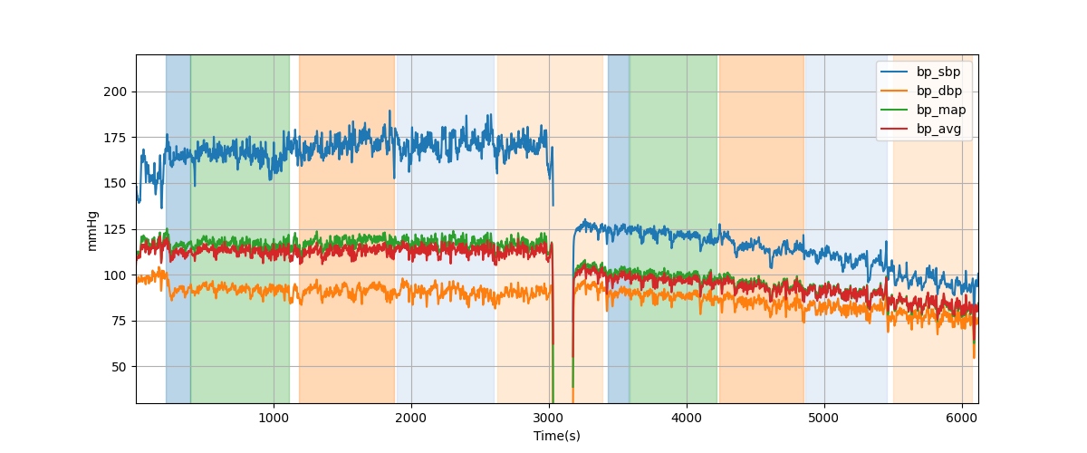 Subject S027 blood pressure data processing summary - Overlay