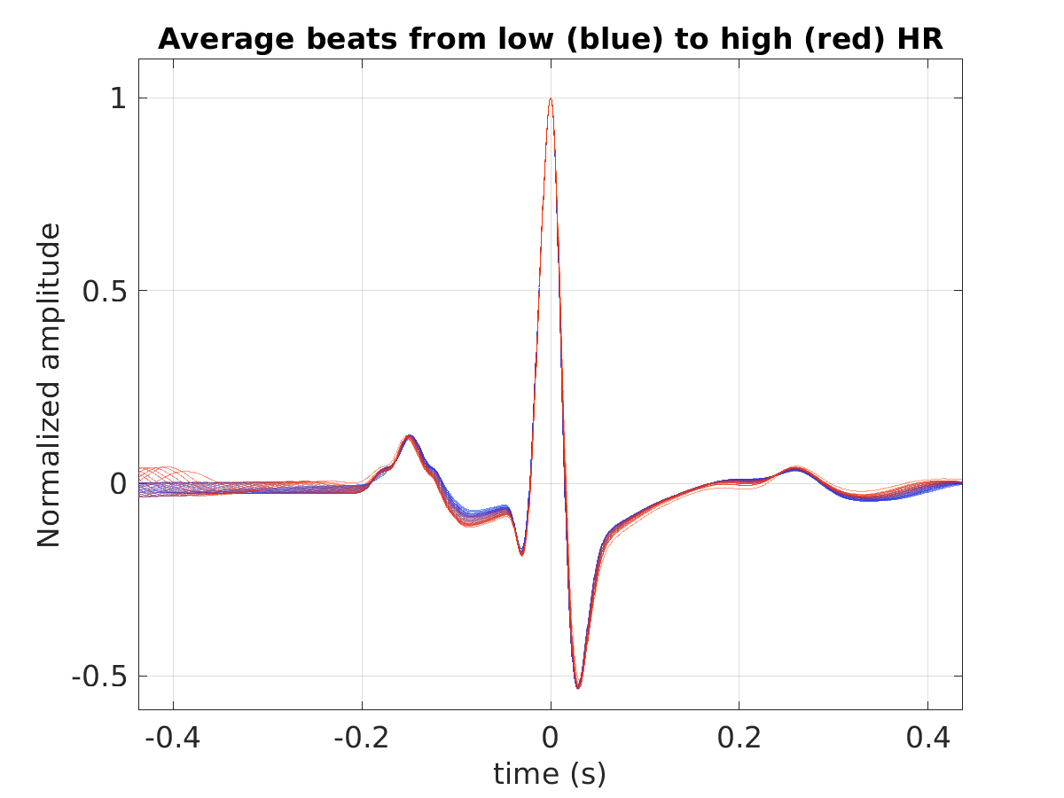 S027_ecg_avg_beats_hr_binned