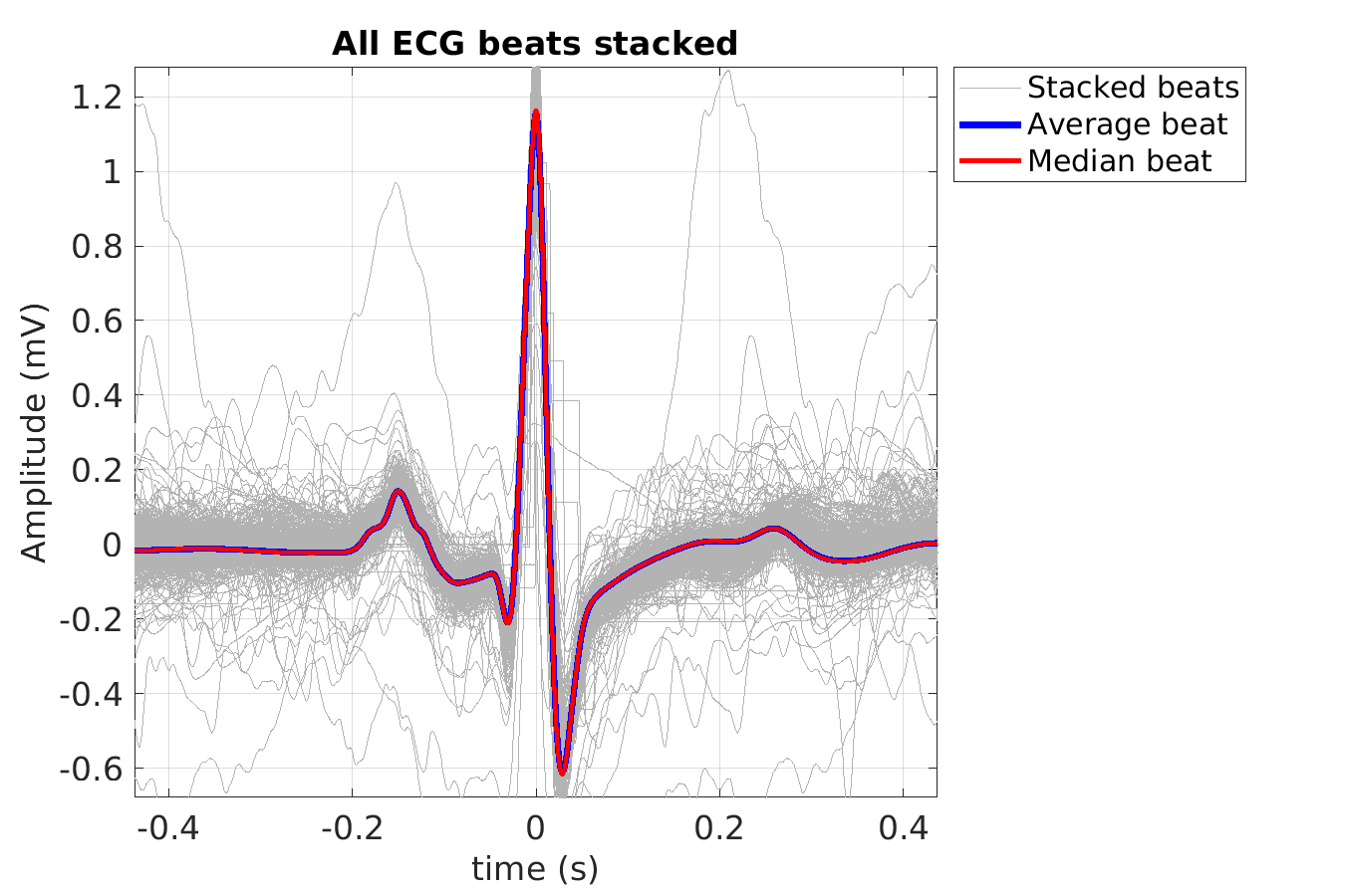 S027_ecg_beats_stacked