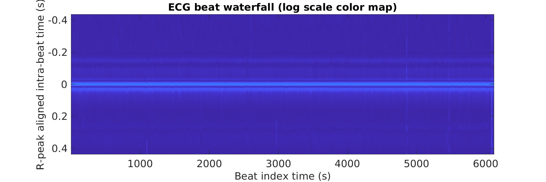 S027_ecg_beats_waterfall_logscale