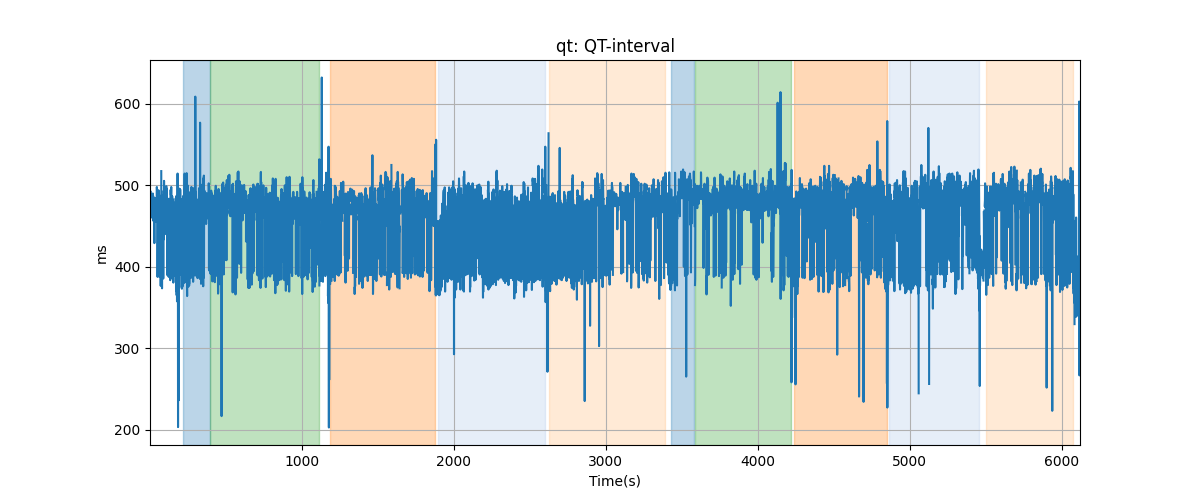 qt: QT-interval