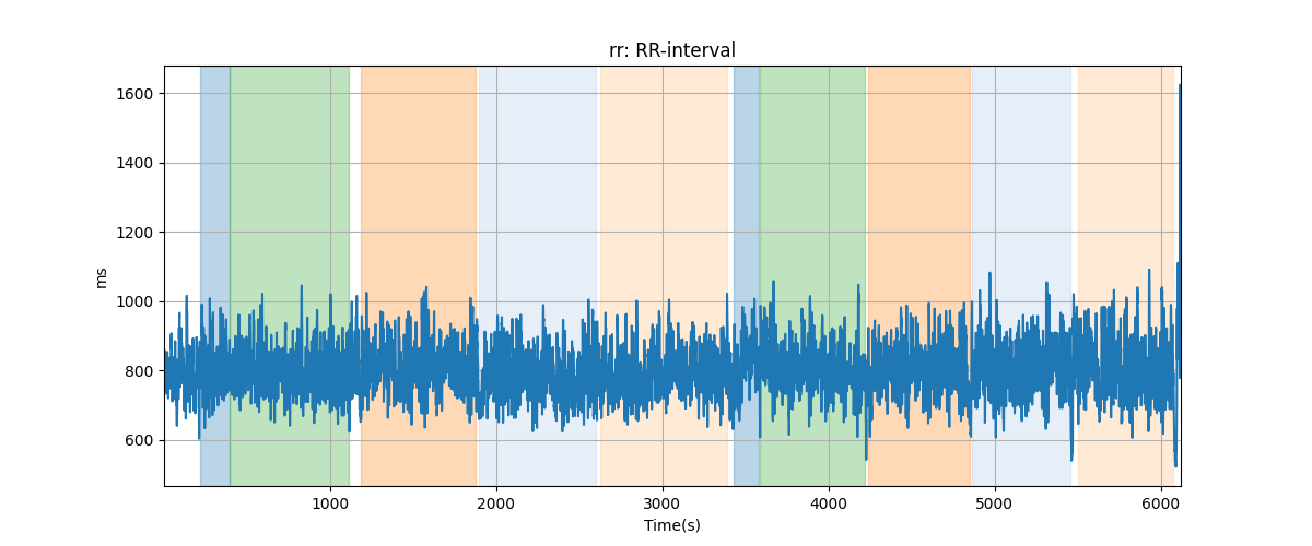 rr: RR-interval