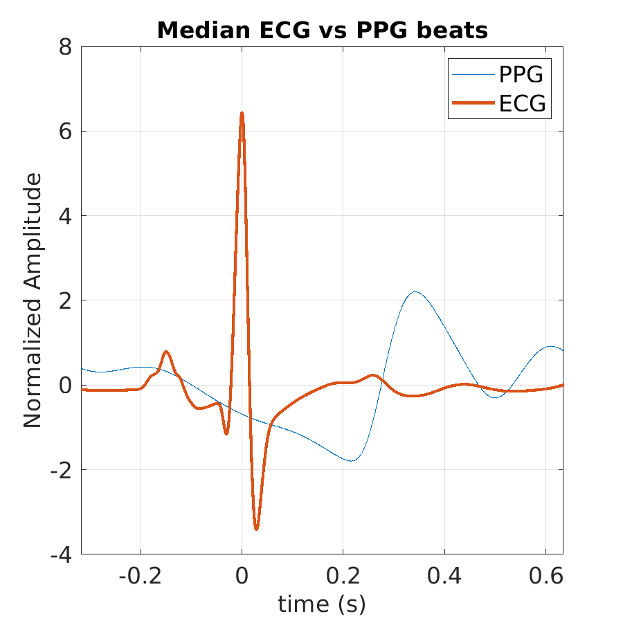 S027_ppg_med_ecg_ppg