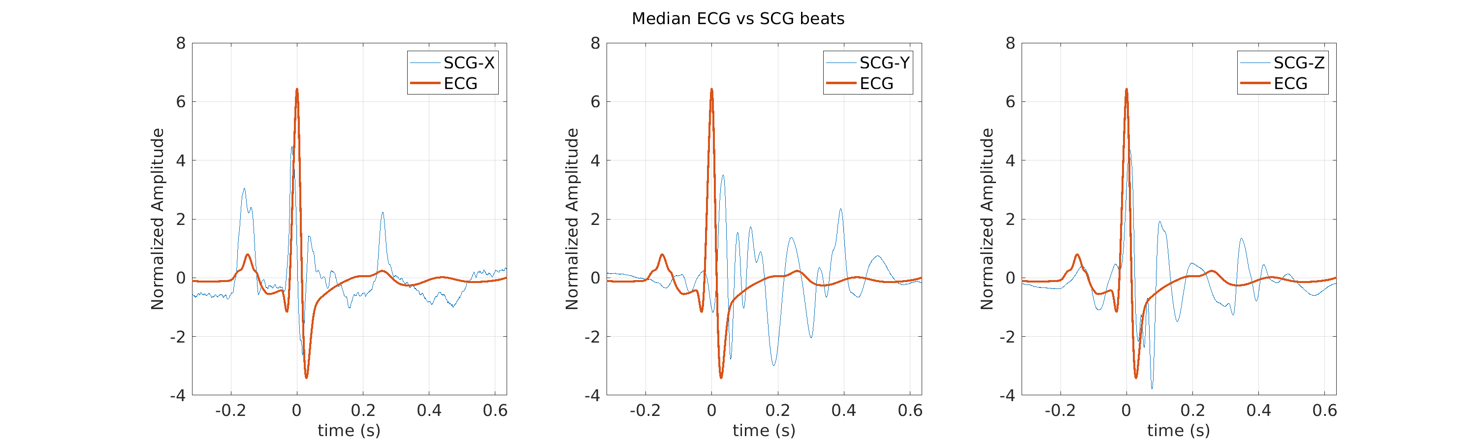 S027_scg_med_ecg_scg