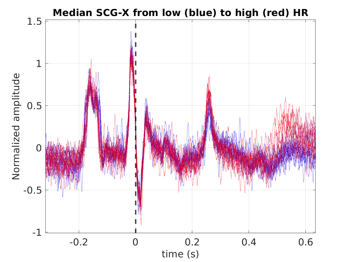 S027_scg_med_scgx_hr_binned_norm