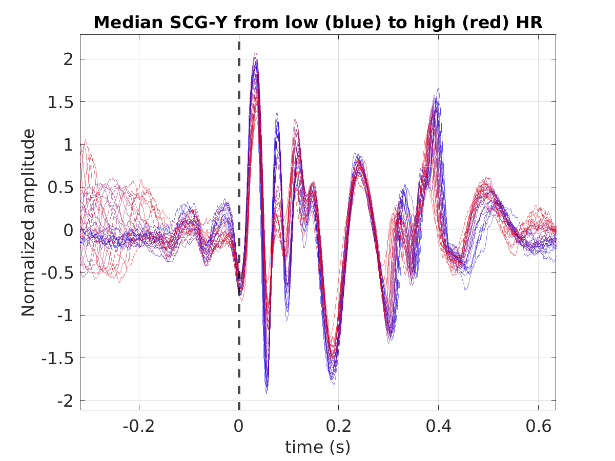 S027_scg_med_scgy_hr_binned_norm