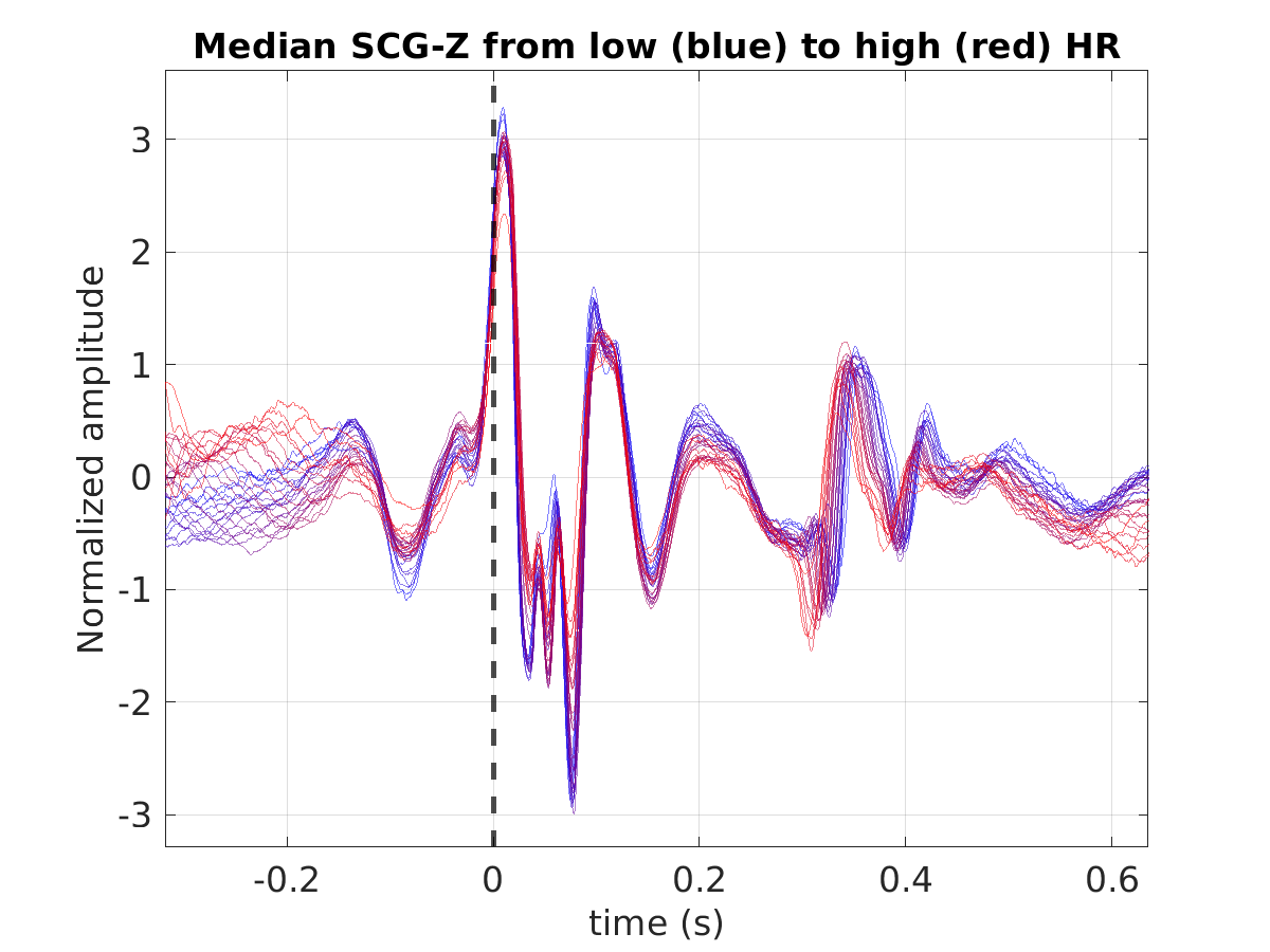 S027_scg_med_scgz_hr_binned_norm