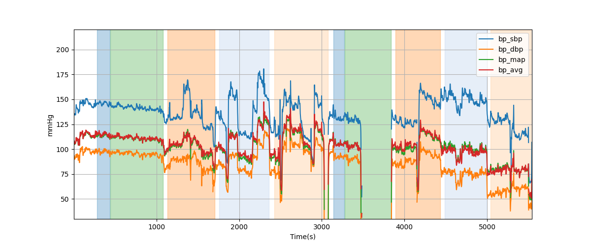 Subject S028 blood pressure data processing summary - Overlay