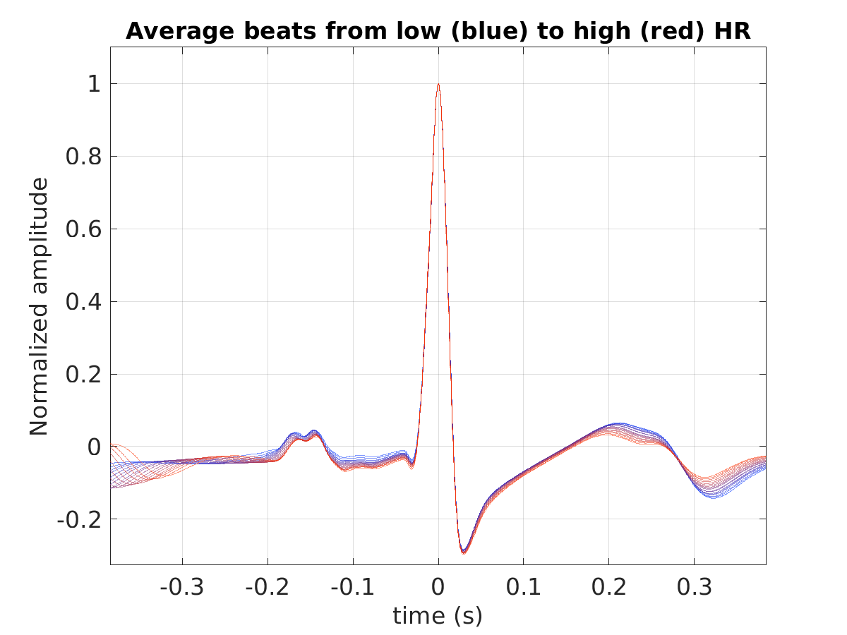 S028_ecg_avg_beats_hr_binned