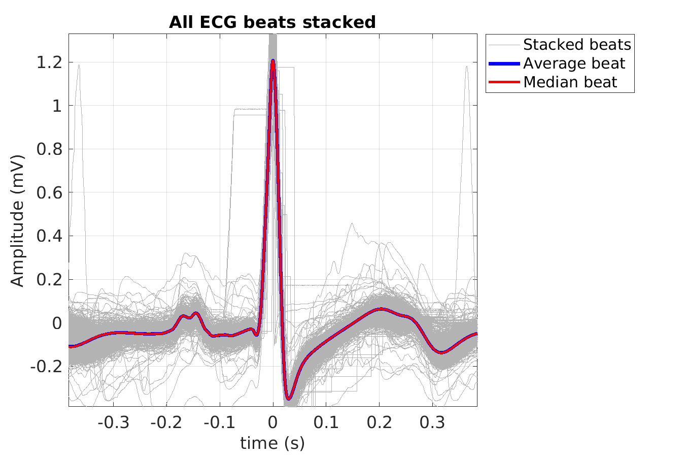 S028_ecg_beats_stacked