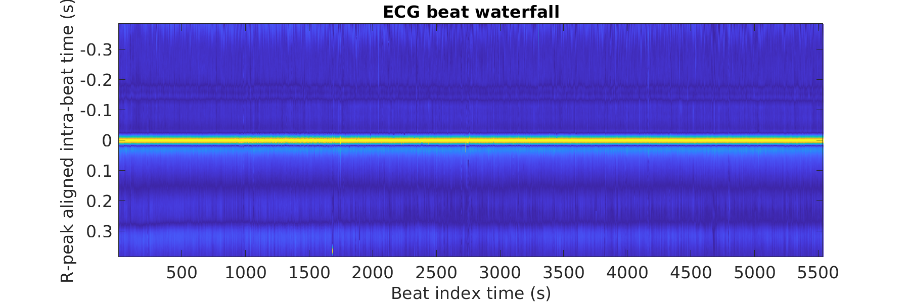 S028_ecg_beats_waterfall