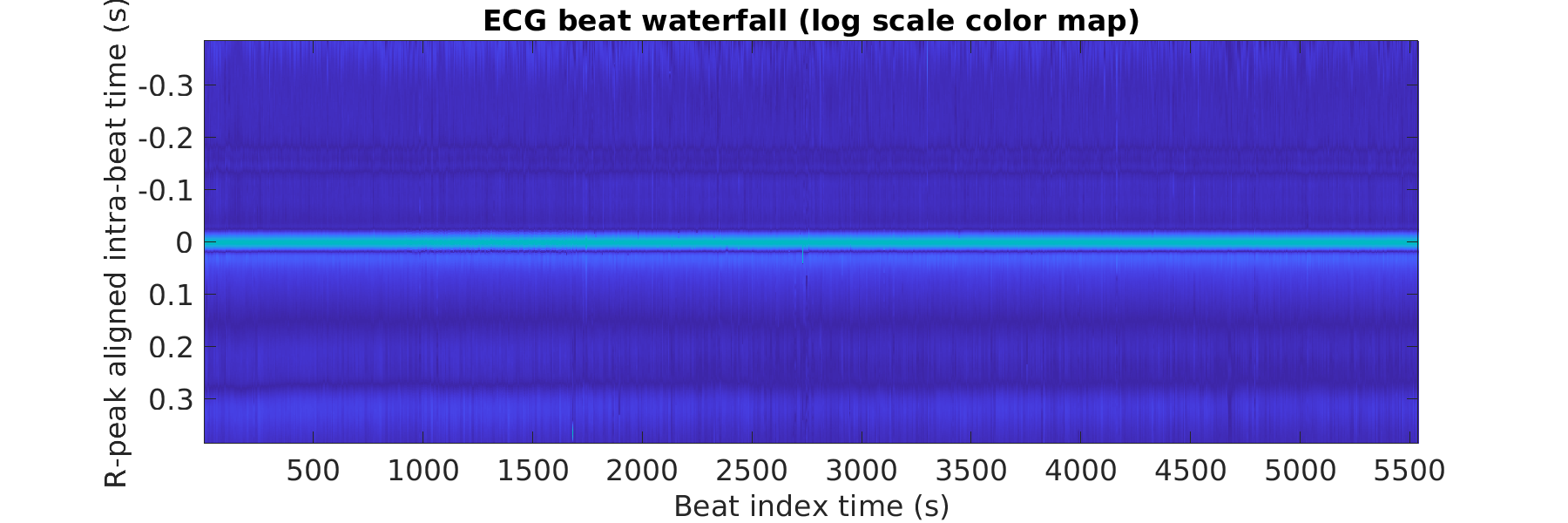 S028_ecg_beats_waterfall_logscale