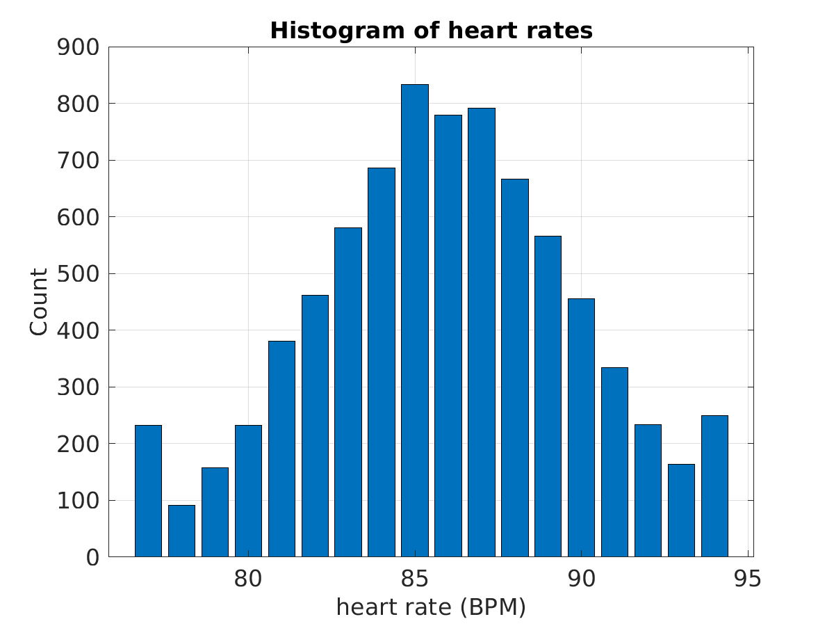 S028_ecg_hr_hist