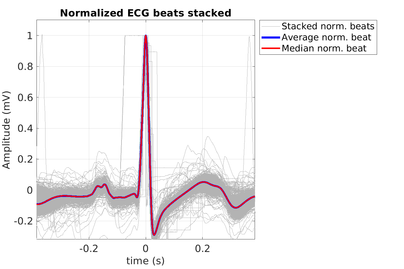 S028_ecg_norm_beats_stacked