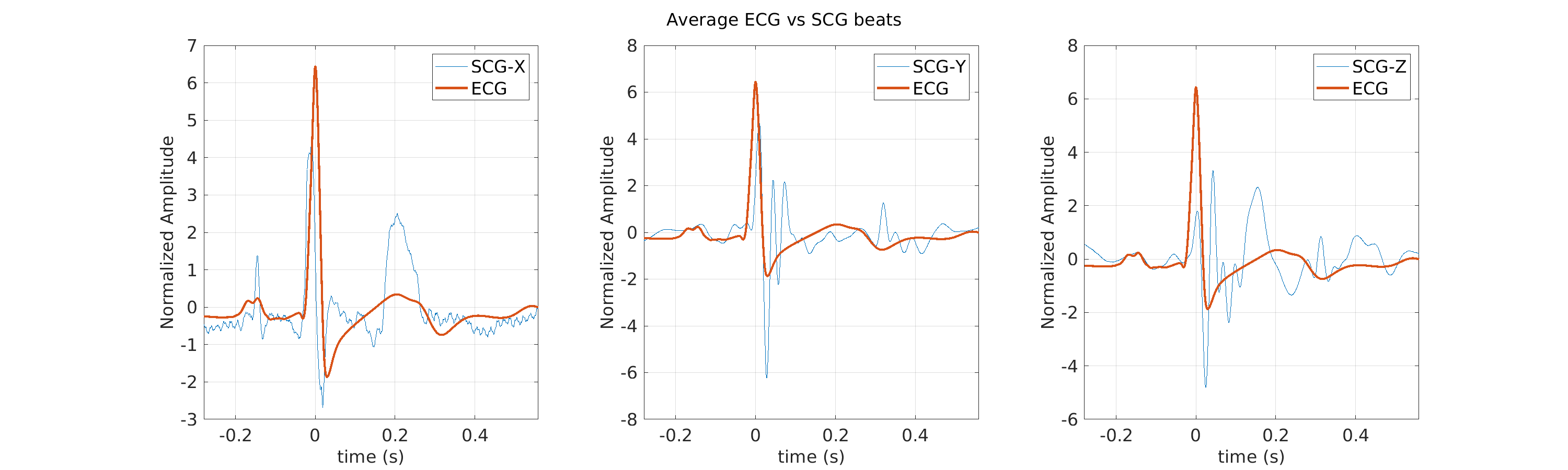 S028_scg_avg_ecg_scg