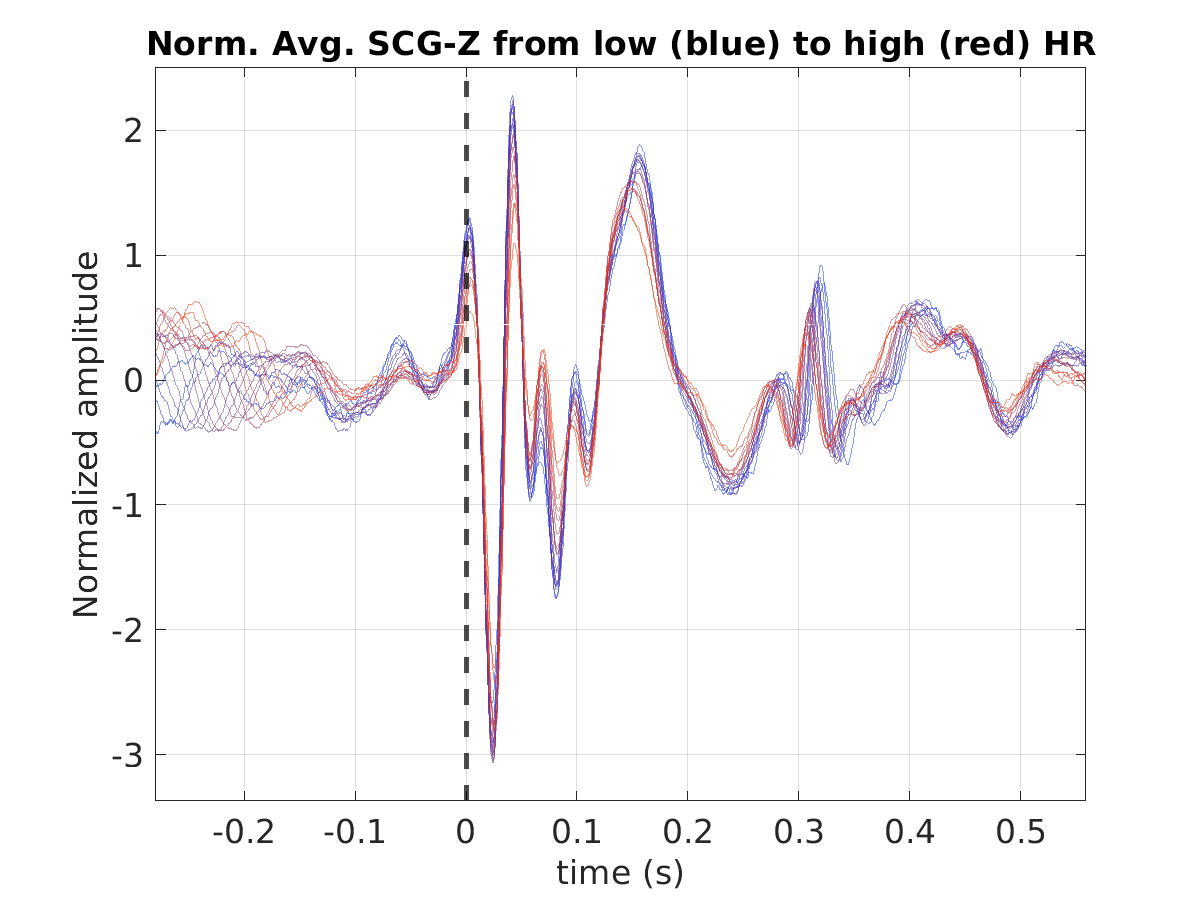 S028_scg_avg_scgz_hr_binned_norm