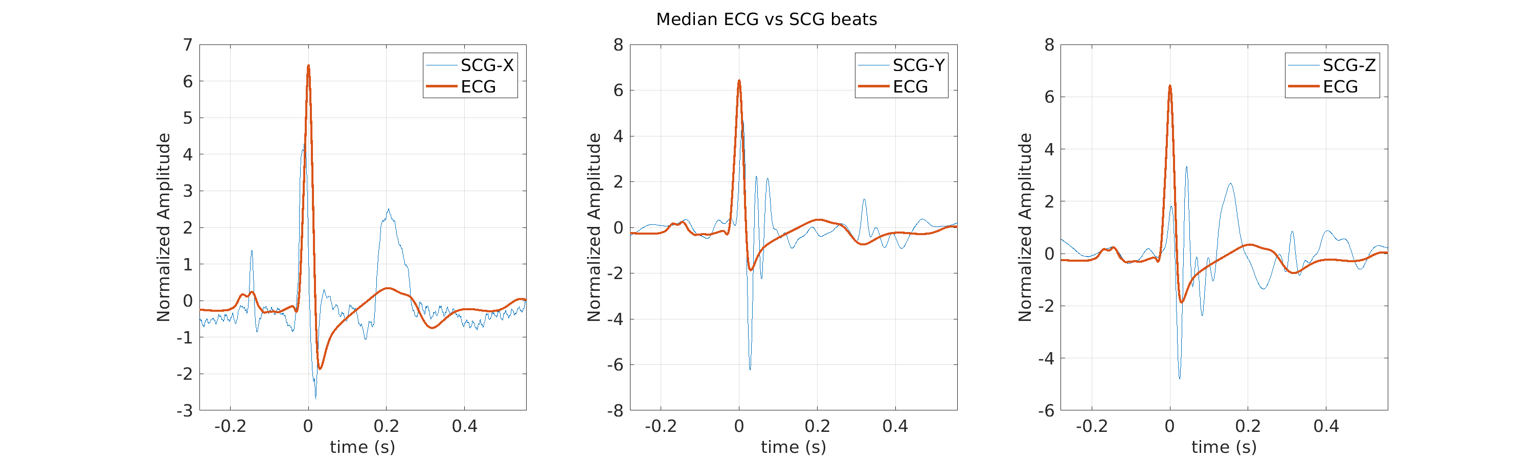 S028_scg_med_ecg_scg